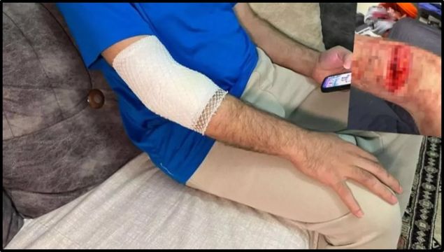 Başakşehir'de özel güvenlik görevlisi, site sakinin köpeği tarafından kolundan ısırıldı.